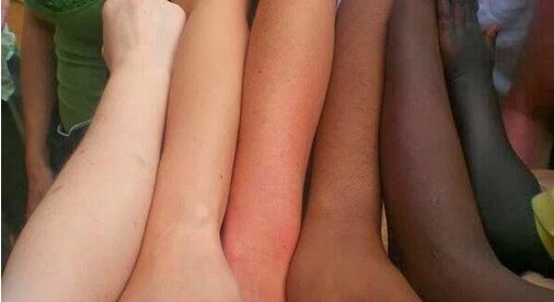 Welche Farbe hat Haut?